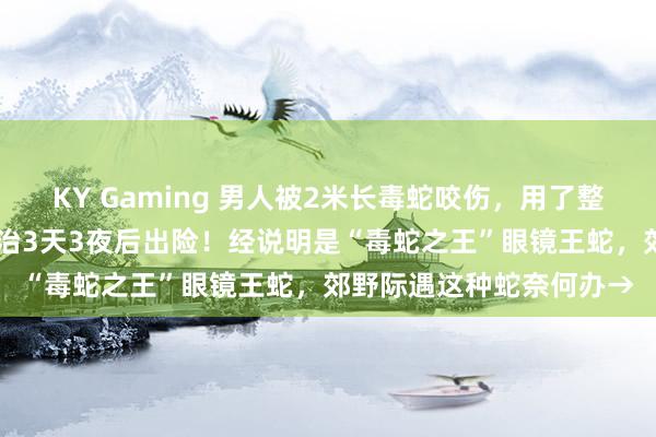 KY Gaming 男人被2米长毒蛇咬伤，用了整整13支抗蛇毒血清，救治3天3夜后出险！经说明是“毒蛇之王”眼镜王蛇，郊野际遇这种蛇奈何办→